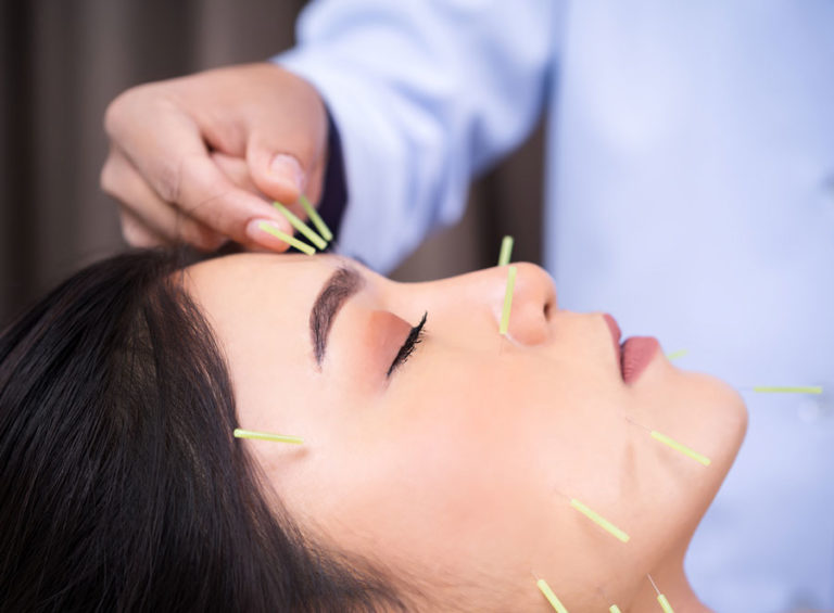 Acupuncture in Edison, NJ Backsmart Wellness Center